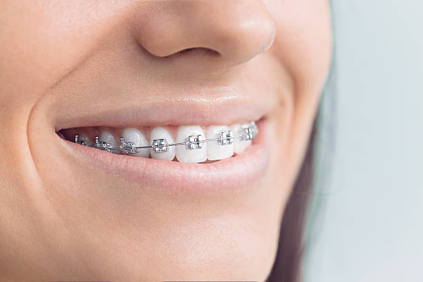 Laser Dentistry in Pineville, LA